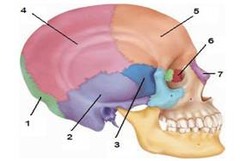 Parietal Bone