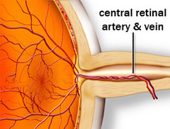 central artery